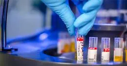 Coronavirus, diventano venti i laboratori per i test in Sicilia: ecco dove sono