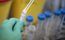 Coronavirus, c'&egrave; un altro contagiato a Castrofilippo