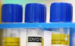 Coronavirus, a Siracusa attende da 11 giorni l'esito del tampone: &laquo;&Egrave; stato perso&raquo;