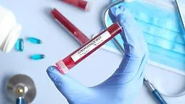 Indagine di siero prevalenza coronavirus in Sicilia, ecco i 120 Comuni interessati
