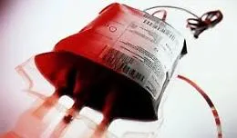 Morta per trasfusione con sangue infetto, risarcimento cospicuo per i familiari