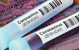 Coronavirus, test rapidi a campione a Racalmuto