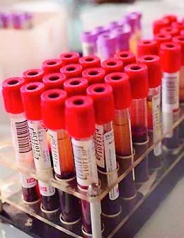 Coronavirus, la curva dei contagi torna a salire in provincia di Agrigento