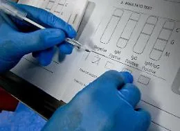 Coronavirus, a breve i test ematici per l'immunit&agrave;: prima i lavoratori &ldquo;strategici&rdquo;