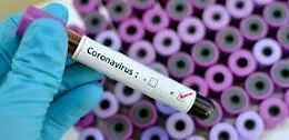 Coronavirus, il focolaio di S. G. La Punta
&laquo;Sedici giorni per avere i referti dei tamponi&raquo;