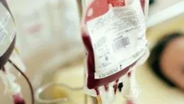 Trasfusione di sangue errata, il tribunale di Catania condanna il Ministero della Salute