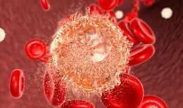 Leucemia linfobalstica acuta scomparsa nell'86%  dei pazienti con cellule Carcik