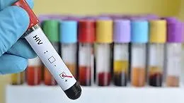 Giornata mondiale contro l'Aids, &laquo;a Catania serve pi&ugrave; prevenzione per fermare le nuove infezioni&raquo;