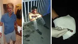 Catania, commissario aggredito, uno dei migranti ha precedenti: &egrave; polemica