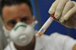 Caso di meningite a Palermo: anziana ricoverata all'ospedale Cervello