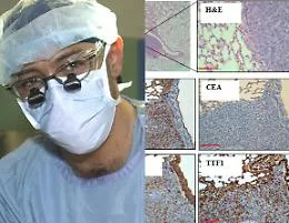 Tumori, l'arresto del processo metastatico nel sensazionale studio di un medico catanese