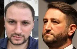 Grillini contro, Cappellani: &laquo;Follia il tunnel di Cancelleri, meglio il Ponte&raquo;