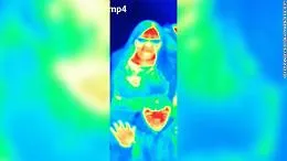 Fa (per gioco) una foto con una termocamera e scopre di avere il cancro
