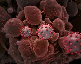 La variante Delta ha una carica virale 300 volte pi&ugrave; alta del virus originario