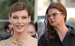 Linda Evangelista shock: &laquo;Sfigurata da un trattamento estetico&raquo;