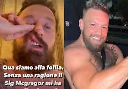 Aggressione shock per Francesco Facchinetti: &laquo;Conor McGregor mi ha dato un pugno in faccia senza motivo&raquo;