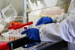 Nuova variante del virus SarsCoV2 individuata in Africa