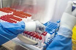Covid, in Sicilia il virus rallenta la sua corsa e gli ospedali "respirano"