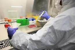 Sla, arriva la prima cura per pazienti con mutazioni specifiche