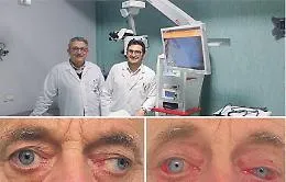 Strabismo: cause, sintomi, diagnosi e correzioni