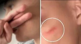 Sfida della &ldquo;cicatrice francese&rdquo;, l'Antistrust indaga su TikTok: sott'accusa l'algoritmo