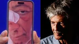 &laquo;Atterro di faccia&raquo;: la caduta (autoironica) di Fiorello in bicicletta, il racconto dal palco e la foto delle ferite
