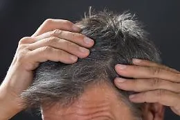 Speranze per combattere la calvizie, nelle cellule adipose il segreto per far ricrescere i  capelli
