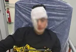 Ragazzino pestato da una baby gang in piazza Stesicoro a Catania: padre posta la foto e scatta l'appello per pi&ugrave; sicurezza