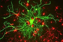 Lo studio dell'istituto di Cristallografia di Catania sulla molecola smart contro l'Alzheimer, aiuta le difese naturali