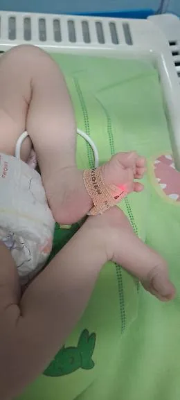 Piccolo guerriero torna a casa: il bimbo prematuro operato al cuore &egrave; fuori pericolo