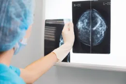 Nuovo studio: &laquo;Il tumore al seno &egrave; il pi&ugrave; diffuso al mondo. Ecco i sei fattori di rischio&raquo;