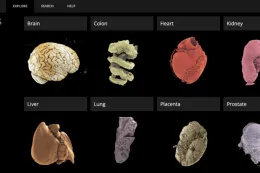 La Google Earth del corpo umano: sul web un viaggio negli organi umani come non lo avete mai visto prima 
