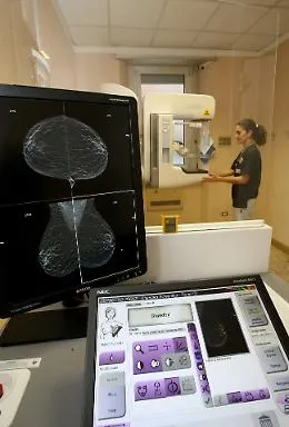Le metastasi "liquide" del tumore al seno si diffondono come gocce d'acqua: una proteina facilita la dispersione