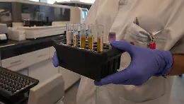 Ritirato lo studio sulla terapia mirata per il cancro al pancreas: c'&egrave; un conflitto d'interess con Vega Oncotargets