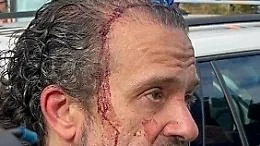 Modena, passante eroe: Luca Signorelli blocca l'uomo col coltello dopo l'auto che travolge i passanti