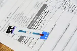 HIV in Sicilia 2024: meno diagnosi, ma resta l'allarme per le scoperte tardive della malattia