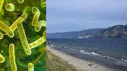 Vibrio vulnificus, il &ldquo;batterio mangiacarne&rdquo; nello Stretto: cosa sappiamo davvero e quanto &egrave; il rischio in Sicilia