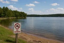 Dramma al lago in Louisiana: muore una bambina di otto anni per l&rsquo;ameba mangia-cervello
