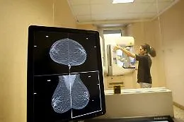 In Sicilia una donna su nove rischia di avere una diagnosi di tumore al seno: in media 3.665 nuovi casi l'anno
