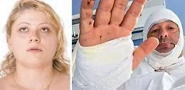 Acido contro il legale a Messina, lo sfregio, la fuga e la cattura a Catania: la donna &ldquo;tradita&rdquo; dal cellulare