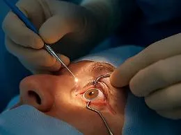 Cataratta, dopo l&rsquo;infezione all'occhio anche il distacco della retina