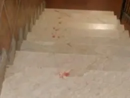 Catania, il &ldquo;bullo&rdquo; gambizzato per 40 euro. Il movente shock: &laquo;Lo ha educato&raquo;