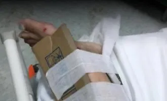 Annullata la multa alla dottoressa che aveva immobilizzato una caviglia con un cartone