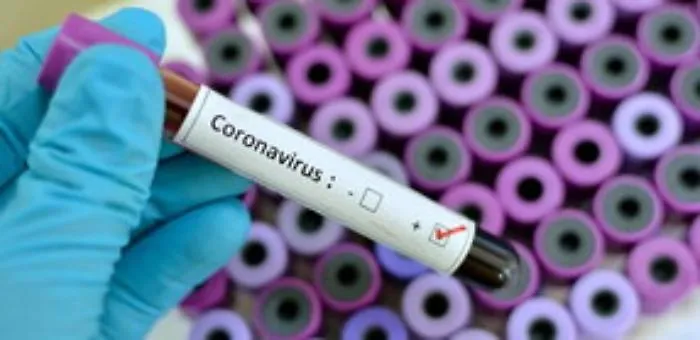 Messina, all'Asp test anti covid con il risultato in 20 minuti