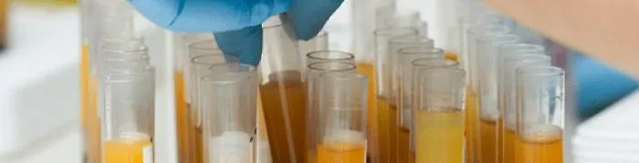 Primo paziente, in provincia di Agrigento, curato con il plasma iperimmune