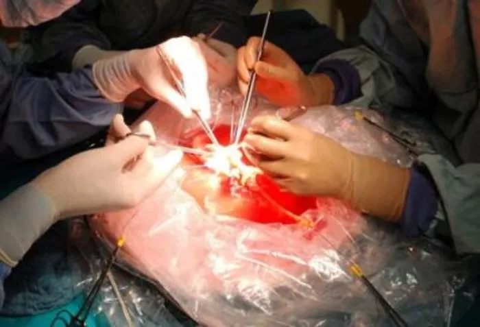 Sciacca, bambina di 10 anni muore per un aneurisma, i genitori donano gli organi