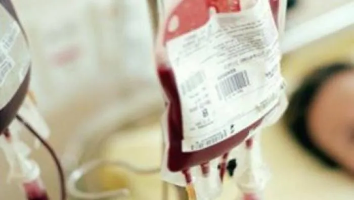 Trasfusione, risarcimento danni ad eredi di una donna morta per cirrosi epatica