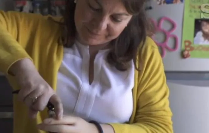 La siciliana Clara e la sua mano bionica che sembra naturale