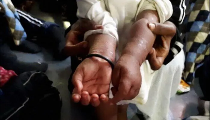 Migranti, a Catania la nave Aquasius con il suo carico di orrori