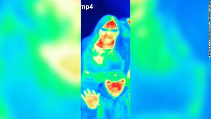 Fa (per gioco) una foto con una termocamera e scopre di avere il cancro
